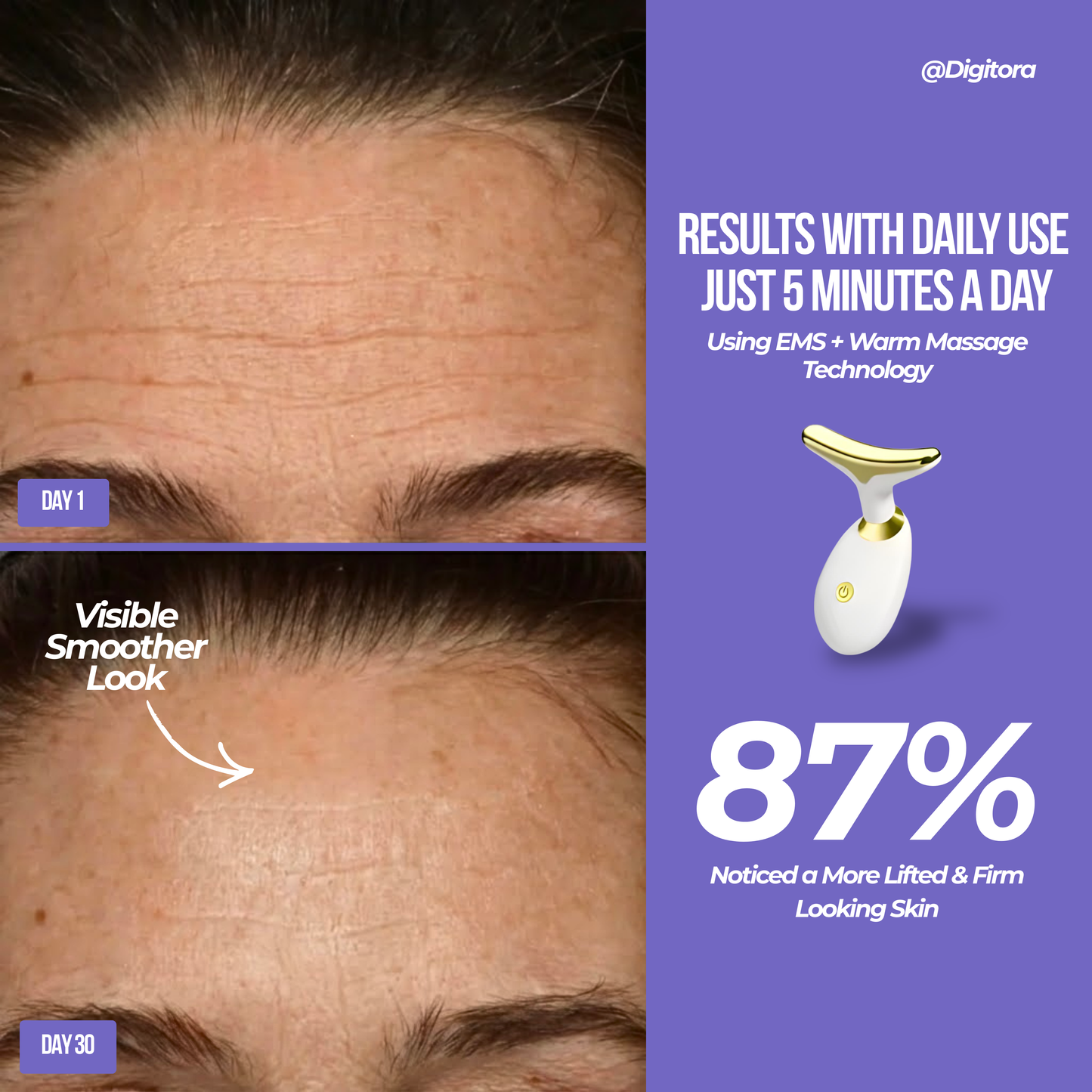 PureLift Skin Lifter